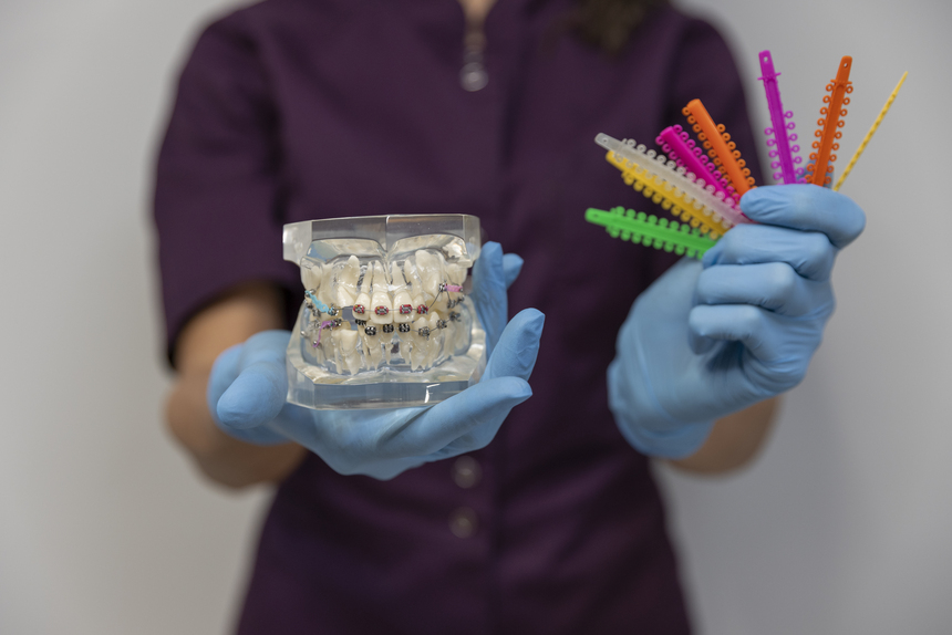 Dental Braces and Orthodontics in Canada Corner Nashik