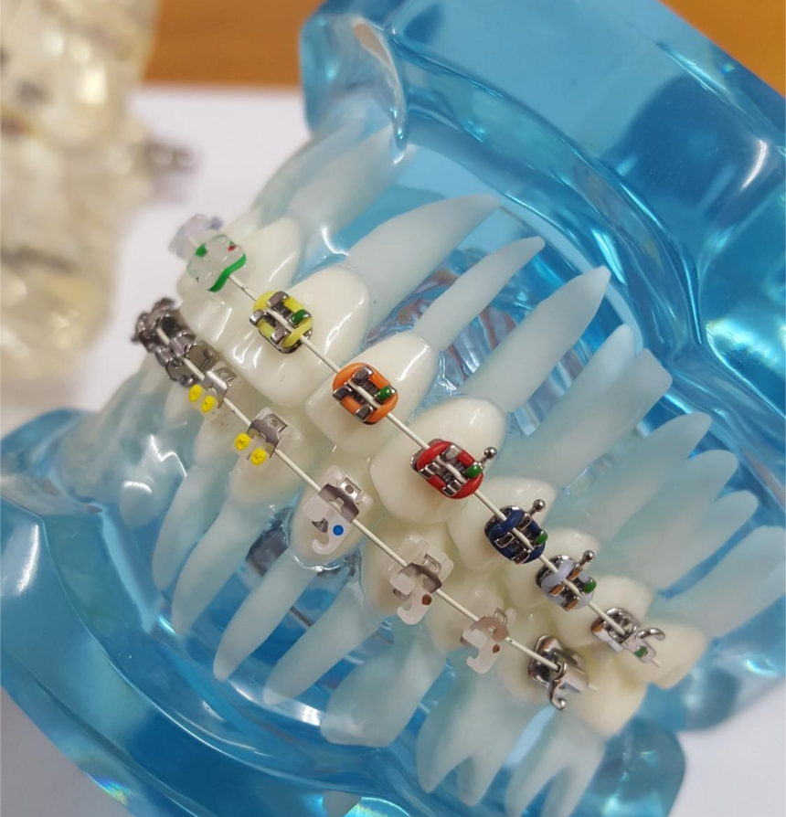 Dental Braces and Orthodontics in College Road Nashik