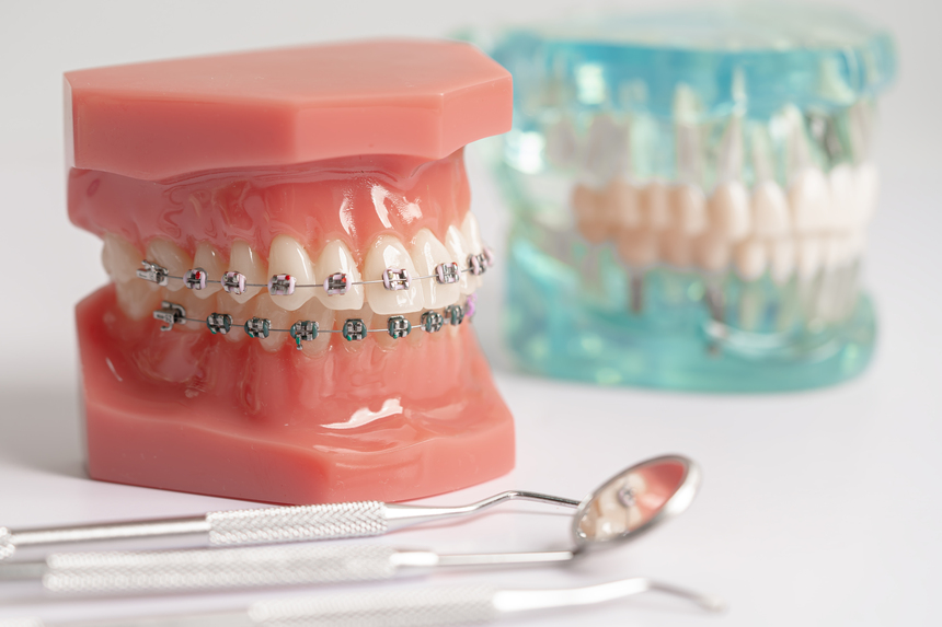 Dental Braces & Orthodontics in Mahatma Nagar Nashik
