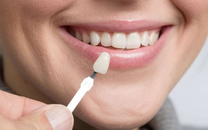 How Cosmetic Dentistry Can Transform Your Smile