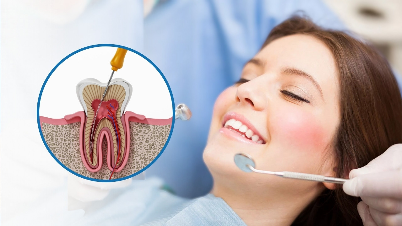 Painless Root Canal Treatment in Nashik Care32 Dental Centre