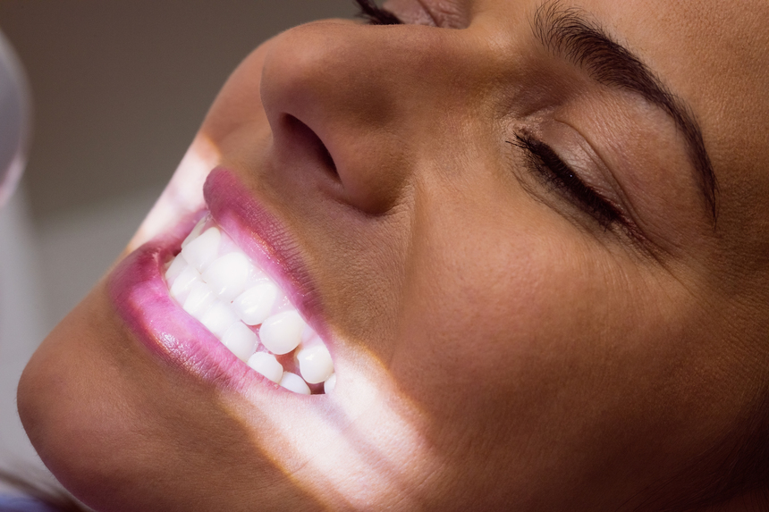Teeth Whitening in Canada Corner  Nashik | Affordable service
