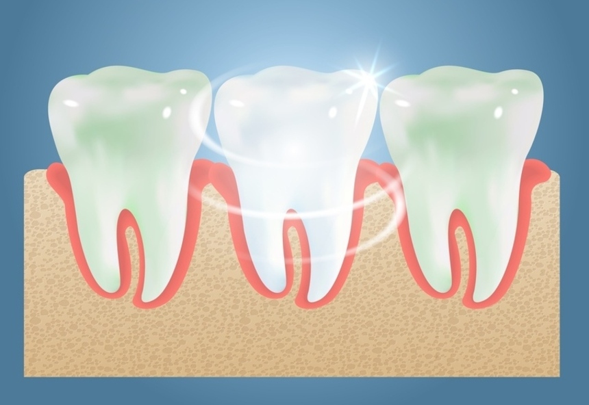 Teeth Whitening in College Road Nashik - Care32 Dental Clinic